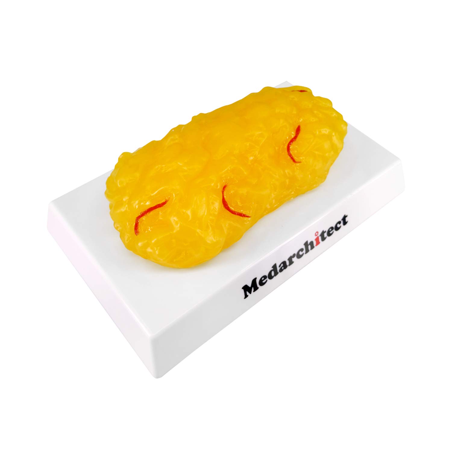 Modelo Anatómico de Grasa Corporal | Réplica de Tejido Adiposo Humano 450gm